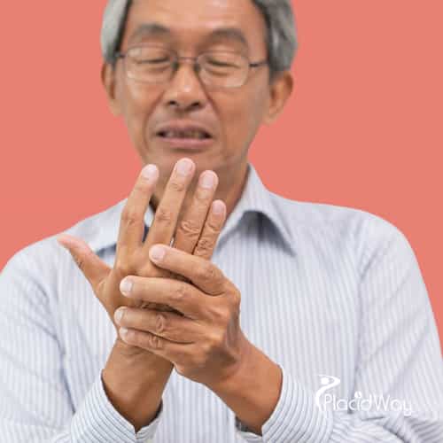 ¿Por qué los canadienses con artritis reumatoide acuden en masa a Medellín, Colombia, en busca de alivio regenerativo?